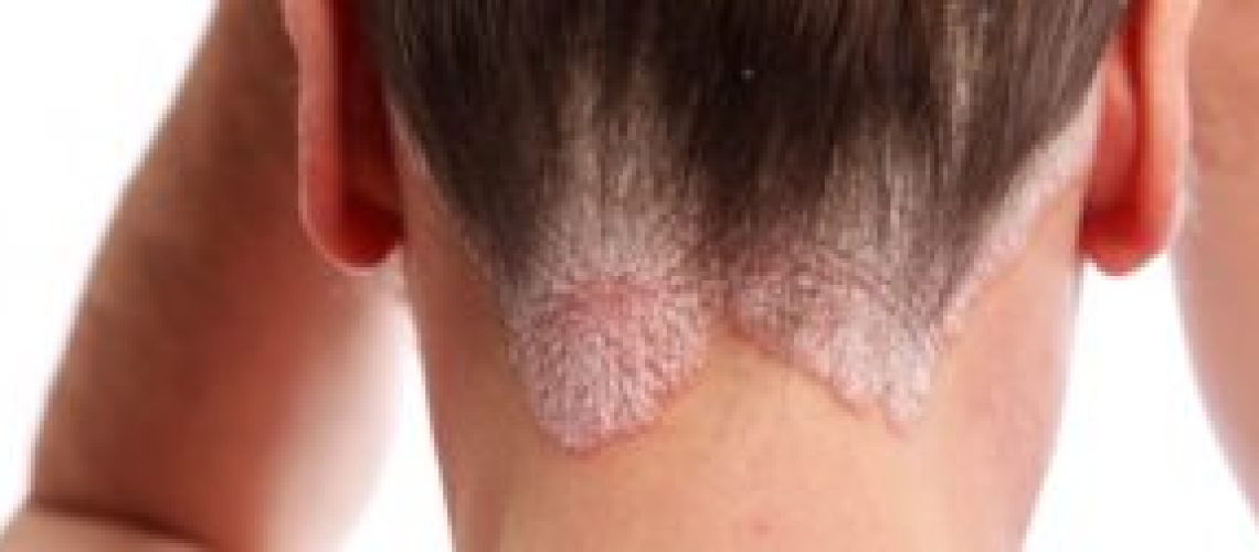 34563175684_719d77e1c0_o-300x126