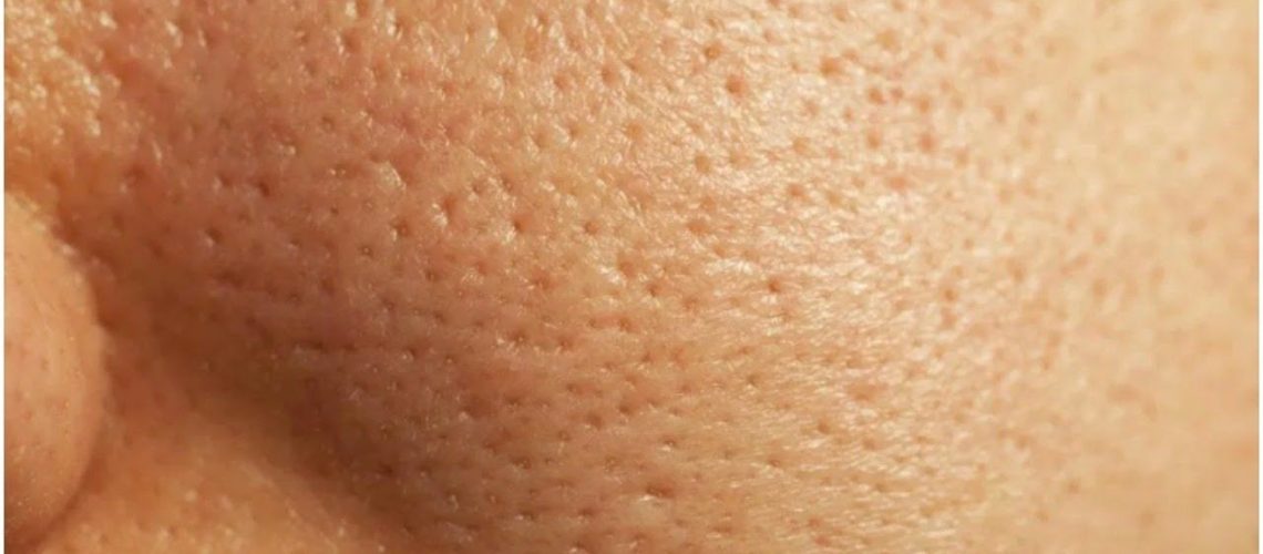 5e9fe89494f2e7029ffdb513e058bd0b